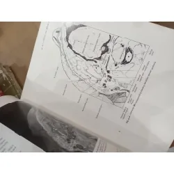 Head and neck cancer - L. B. Harrison, R. B. Sessions, W. K. Hong 703629