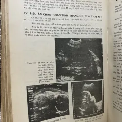 Bài giảng sản phụ khoa 2 tập - 1990, sách khổ lớn; khoảng 700 trang  1006351