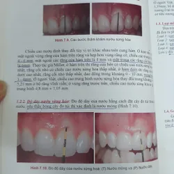 CẤY GHÉP NHA KHOA 740877