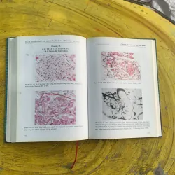 ATLAS MÔ BỆNH HỌC CÁC BỆNH CẦU THẬN & BỆNH ỐNG - KẼ THẬN 1009009