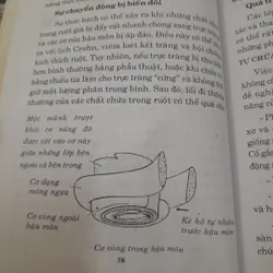 Chứng táo bón- Liệu pháp phòng chống tiêu chảy, táo bón và rối lọa tiêu hóa khác. 694009