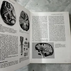 An Atlas of clinical neurology  1041102