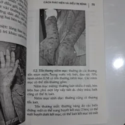 Các bệnh về da liễu phát hiện và điều trị 995555