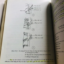 3. BÀI GIẢNG GIẢI PHẪU HỌC ( đủ bộ 2 tập) 536641