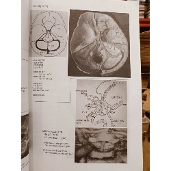 Hình ảnh học sọ não - Jacques Clarisse, Nguyễn Thi Hùng, Phạm Ngọc Hoa 929913