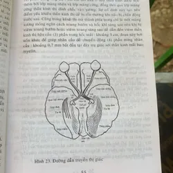 Giáo trình nhãn khoa, Nguyễn Xuân Trường 713182