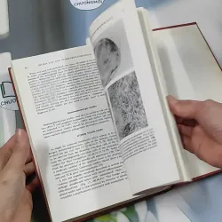 [MIỄN PHÍ BỌC SÁCH] Biopsy Interpretation of Lymph Nodes - Steven H. Swerdlow 750751