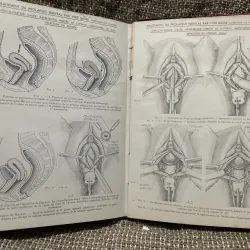 Kthuật phẫu thuật bằng hình ảnh -TECHNIQUE CHIRURGIEALE EN FIGURES G.JEANNENEY& J.MAGENDIE 1006345