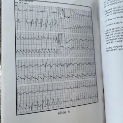 Máy Tạo nhịp tim cơ bản và thực hành: khổ lớn, 1994 1025048