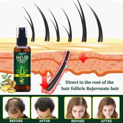 Serum dưỡng mọc tóc, giúp tóc mọc nhanh, nhiều và dày, sợi tóc đen bóng 800860