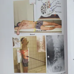 KỸ THUẬT CHỤP X QUANG 738448