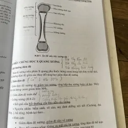Bài giảng chẩn đoán x Quang - PGS.TS. PHẠM NGỌC HOA ThS. LÊ VĂN PHƯỚC 1040505