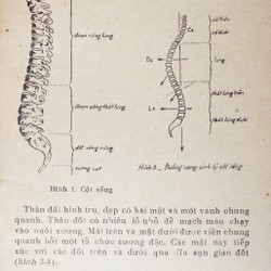 Đau cột sống đoạn thắt lưng 169373