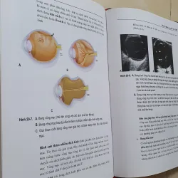 SIÊU ÂM TỔNG QUÁT  957610