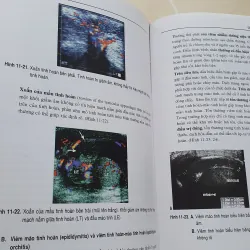 SIÊU ÂM TỔNG QUÁT  957610