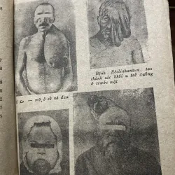 Các bệnh ngoại khoa - N.N. ÊLANXKI hơn 700 trang , dịch từ nước ngoài  799772