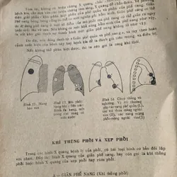 Chuẩn đoán X quang lâm sàng, Đặng Văn Ấn 608559