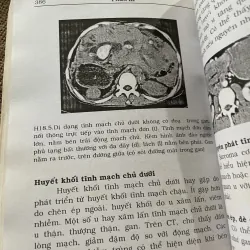 Sách y - CT BỤNG VÀ CHẬU - 450 trang  791924