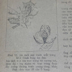 PHẪU THUẬT ỐNG TIẾU HOÁ - sách y học, Tây Y , khổ lớn  539876