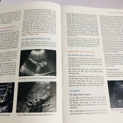 📚 SỎI ĐƯỜNG MẬT – Nguyễn Đình Hối, Nguyễn Mậu Anh 539457