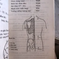 Châm cứu trị di chứng viêm não - Bác sĩ Nguyễn Thị Trương  1027837