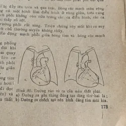 Chuẩn đoán X quang lâm sàng, Đặng Văn Ấn 608559