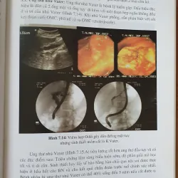 NỘI SOI MẶT TUY  754032