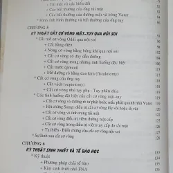 NỘI SOI MẶT TUY  754032