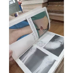 Diagnostic picture tests in injury in sport - J.G.P. Williams 1026695