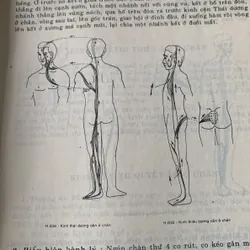 Châm cứu học, nhiều hình ảnh minh hoạ 608337