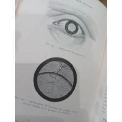 Ophtalmologie - A. Cantonnet 551398