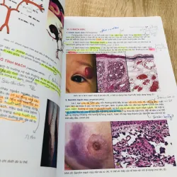 BÀI GIẢNG LÝ THUYẾT GIẢI PHẪU BỆNH  1004278