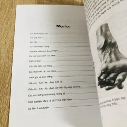 BỆNH VIÊM KHỚP DẠNG THẤP  1017620