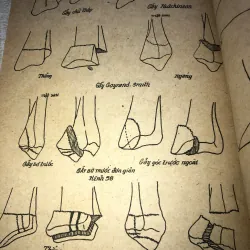 Gẫy Xương Chi Trên-Nhiều Tác Giả 971692