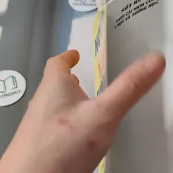 Nốt Ruồi Dưới Cái Nhìn Y Học & Tướng Học - Như Hùng 727280