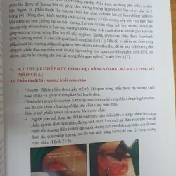 CẤY GHÉP NHA KHOA 740877