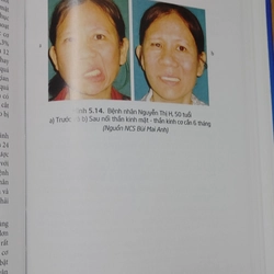 LIỆT MẶT PHƯƠNG PHÁP....  502936