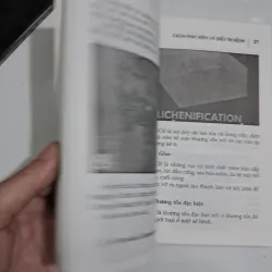 Các bệnh về da liễu phát hiện và điều trị 995555
