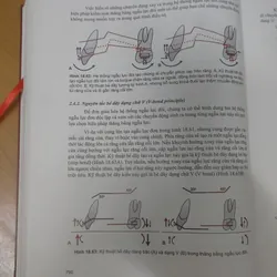 CHỈNH NHA LÂM SÀNG TẬP 1 689476