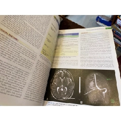 Merritt’s Neurology, 13 edition 760547