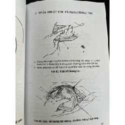 Sổ tay phẫu thuật bằng hình vẽ - Nguyễn Khánh Dư 970642