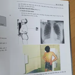 KỸ THUẬT CHỤP X QUANG 738448