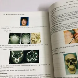 GIÁO TRÌNH ĐẠI HỌC TAI MŨI HỌNG  726490