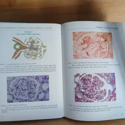 Atlast Mô Bệnh Học Các Bệnh Cầu Thận & Bệnh Ống - Kẽ Thận 799329