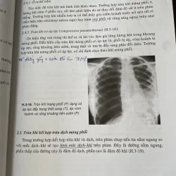 Bài giảng chẩn đoán x Quang - PGS.TS. PHẠM NGỌC HOA ThS. LÊ VĂN PHƯỚC 1040505