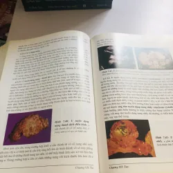 SIÊU ÂM BỤNG TỔNG QUÁT 2006 756264