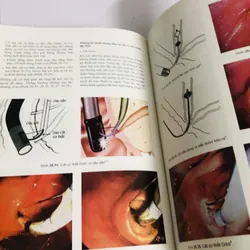 📘 SỎI ĐƯỜNG MẬT – Nguyễn Đình Hối & Nguyễn Mậu Anh 700887