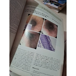GIE Gastrointestinal Endoscopy volume 77 no 1 1/2013 HCM0808 TẠP CHÍ, THIẾT KẾ, THỜI TRANG 527277
