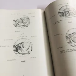 TÀI LIỆU HƯỚNG DẪN PHẪU THUẬT NỘI SOI 780444