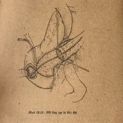 Bài giảng Điều trị học ngoại khoa, Trương Công Trung - Nguyễn Đình Hối 710862